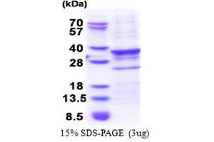 CENPQ Protein (AA 1-268) (His tag)