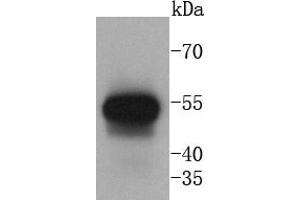 Human lung lysates probed with Cytokeratin 13 (5A3) Monoclonal Antibody at 1:1000 overnight at 4˚C. (Cytokeratin 13 抗体)