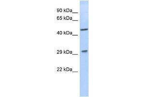 WB Suggested Anti-LIX1 Antibody Titration: 0. (LIX1 抗体  (N-Term))