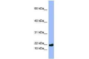 SPRR3 antibody used at 1 ug/ml to detect target protein. (SPRR3 抗体  (Middle Region))