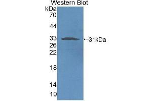 Detection of Recombinant NCR1, Rat using Polyclonal Antibody to Natural Cytotoxicity Triggering Receptor 1 (NCR1) (NCR1 抗体  (AA 17-258))