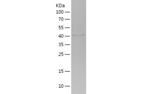 PIK3R1 Protein (AA 44-201) (His-IF2DI Tag)