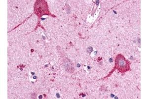 Immunohistochemical staining of Brain (Neurons and glia) using anti- OPN3 antibody ABIN122055 (OPN3 抗体)