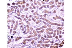 IHC analysis of PON1 using anti-PON1 antibody (ABIN6719356).