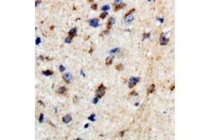 Immunohistochemical analysis of BTBD6 staining in human brain formalin fixed paraffin embedded tissue section. (BTBD6 抗体)