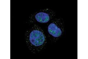 Confocal immunofluorescent analysis of p-Rb1 antibody with HepG2 cells followed by Alexa Fluor 488-conjugated goat anti-rabbit lgG (green). (Retinoblastoma Protein (Rb) 抗体  (pSer811))
