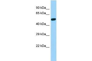 Host:  Rabbit  Target Name:  Psen2  Sample Type:  Rat Stomach lysates  Antibody Dilution:  1. (Presenilin 2 抗体  (C-Term))