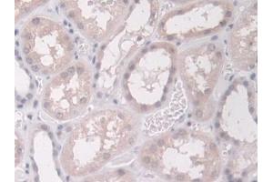 Immunohistochemistry (IHC) image for anti-Proteasome (Prosome, Macropain) Subunit, beta Type, 8 (Large Multifunctional Peptidase 7) (PSMB8) (AA 75-261) antibody (ABIN7440236)