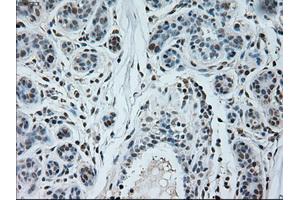 Immunohistochemical staining of paraffin-embedded breast tissue using anti-NEUROG1 mouse monoclonal antibody. (Neurogenin 1 抗体)