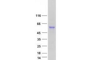 Western Blotting (WB) image for Carboxypeptidase, Vitellogenic-Like (CPVL) (Transcript Variant 2) protein (Myc-DYKDDDDK Tag) (ABIN2712542)