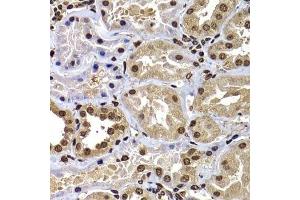 Immunohistochemistry of paraffin-embedded human kidney using DNAJB6 antibody. (DNAJB6 抗体  (AA 177-326))