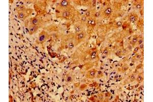 Immunohistochemistry of paraffin-embedded human liver tissue using ABIN7175121 at dilution of 1:100 (Urocortin 2 抗体  (AA 72-112))