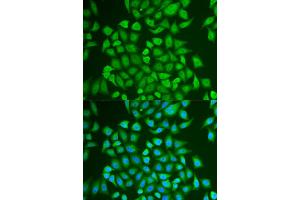 Immunofluorescence analysis of U2OS cells using PIP antibody. (PIP 抗体)