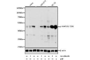 Western blot analysis of extracts of various cell lines, using Phospho-MAP2K1-T286 antibody. (MEK1 抗体  (pThr286))