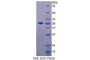 Image no. 1 for Signal Recognition Particle Receptor, B Subunit (SRPRB) (AA 58-271) protein (T7 tag,His tag) (ABIN6238872) (SRPRB Protein (AA 58-271) (T7 tag,His tag))