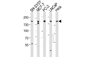 Western blot analysis of lysates from SH-SY5Y, MCF-7, PC-3, LNCaP, Hela, cell line (from left to right), using Tuberin (TSC2) Antibody (ABIN390324 and ABIN2840755).
