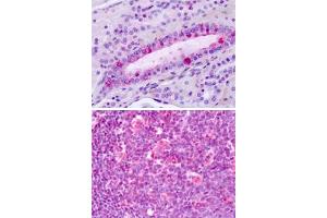 Immunohistochemical staining of formalin-fixed, paraffin-embedded human tonsil with LPHN3 polyclonal antibody . (LPHN3 抗体  (C-Term))