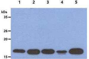 The Cell lysates (40ug) were resolved by SDS-PAGE, transferred to PVDF membrane and probed with anti-human ACP1 antibody (1:1000). (ACP1 抗体)