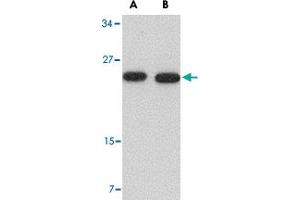 Western blot analysis of POFUT1 in human heart tissue lysate with POFUT1 polyclonal antibody  at (A) 0. (POFUT1 抗体  (N-Term))