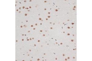 Immunohistochemistry of paraffin-embedded mouse brain using ZNF148 antibody (ABIN6130815, ABIN6150463, ABIN6150464 and ABIN6222770) at dilution of 1:100 (40x lens). (ZNF148 抗体  (AA 690-794))