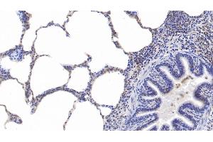 Detection of PSME3 in Human Lung Tissue using Polyclonal Antibody to Proteasome Activator Subunit 3 (PSME3) (PSME3 抗体  (AA 7-254))