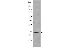 Western blot analysis of GEM expression in 293 lysate,The lane on the left is treated with the antigen-specific peptide. (GEM 抗体  (N-Term))