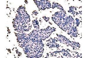 IHC analysis of splicing factor 1 using anti-splicing factor 1 antibody (ABIN7600194).