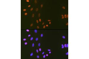 Immunofluorescence analysis of C6 cells using DNA Ligase I Rabbit mAb (ABIN7268251) at dilution of 1:100 (40x lens). (LIG1 抗体)