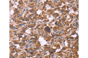 Immunohistochemistry (IHC) image for anti-F-Box and WD Repeat Domain Containing 7 (FBXW7) antibody (ABIN2429748) (FBXW7 抗体)