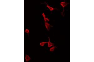 ABIN6269292 staining HeLa by IF/ICC. (Calmodulin 1 抗体)
