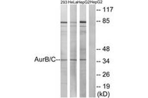 Western blot analysis of extracts from 293/HeLa/HepG2 cells, treated with Paclitaxel 1uM 24h, using AurB/C (Ab-202/175) Antibody. (AurB/C 抗体  (AA 201-250))