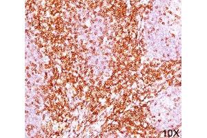 IHC testing of human tonsil (10X) stained with CD6 antibody cocktail (C6/372 + 3F7B5). (CD6 抗体)