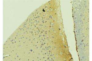 ABIN6273300 at 1/100 staining Mouse brain tissue by IHC-P. (Podoplanin 抗体  (N-Term))