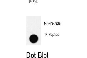 Dot Blot (DB) image for anti-Pancreatic and Duodenal Homeobox 1 (PDX1) (pThr11) antibody (ABIN3001905)