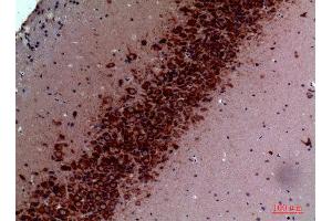 Immunohistochemistry (IHC) image for anti-Transient Receptor Potential Cation Channel, Subfamily C, Member 3 (TRPC3) (Internal Region) antibody (ABIN6283972)
