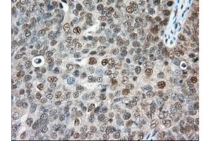 Immunohistochemical staining of paraffin-embedded Human colon tissue using anti-ERCC1 mouse monoclonal antibody. (ERCC1 抗体)