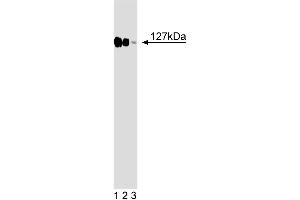 Western blot analysis of DDB1 on a HeLa cell lysate (Human cervical epitheloid carcinoma, ATCC CCL-2. (DDB1 抗体  (AA 739-935))