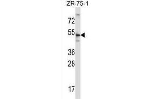 Western Blotting (WB) image for anti-Telomeric Repeat Binding Factor 2 (TERF2) antibody (ABIN2997581) (TRF2 抗体)