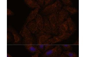 Immunofluorescence analysis of U-2 OS cells using SEPT8 Polyclonal Antibody at dilution of 1:100. (Septin 8 抗体)