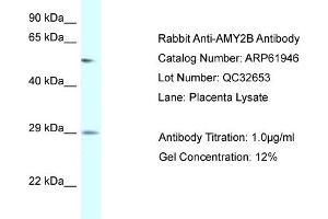 Western Blotting (WB) image for anti-Amylase, alpha 2B (Pancreatic) (AMY2B) (N-Term) antibody (ABIN2774328) (AMY2B 抗体  (N-Term))