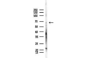 Western blot analysis of lysates from HepG2 cells(starvation,24h treatment), using ARSE Antibody at 1/1000 dilution.