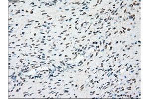 Image no. 4 for anti-Polo-Like Kinase 1 (PLK1) antibody (ABIN1500283)