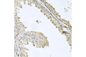 Immunohistochemistry of paraffin-embedded human prostate using CDH5 antibody at dilution of 1:100 (x40 lens). (Cadherin 5 抗体)
