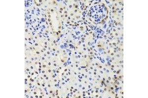 Immunohistochemistry (Paraffin-embedded Sections) (IHC (p)) image for anti-Elongation Factor Tu GTP Binding Domain Containing 2 (EFTUD2) (AA 1-205) antibody (ABIN6139968)