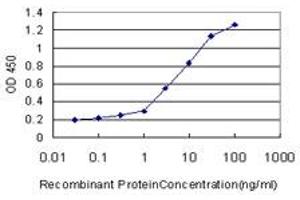 Detection limit for recombinant GST tagged FBXO11 is approximately 0. (FBXO11 抗体  (AA 744-843))
