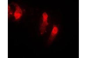 Immunofluorescent analysis of Cystatin B staining in EOC20 cells. (CSTB 抗体  (Center))