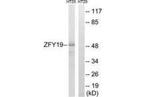 Western blot analysis of extracts from HT-29 cells, using ZFYVE19 Antibody. (ZFYVE19 抗体  (AA 311-360))
