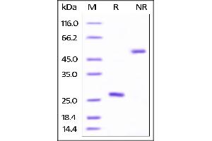 SDS-PAGE (SDS) image for Tumor Necrosis Factor (Ligand) Superfamily, Member 13b (TNFSF13B) (AA 134-285) (Active) protein (His tag,AVI tag,Biotin) (ABIN4949008)