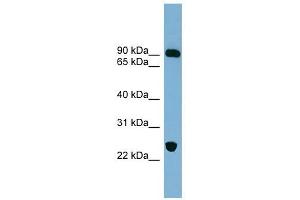 VPS53 antibody used at 1 ug/ml to detect target protein. (VPS53 抗体)