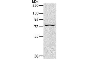 Western blot analysis of Jurkat cell, using TAP2 Polyclonal Antibody at dilution of 1:200 (TAP2 抗体)